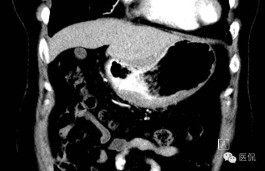 苏州新增14例本土确诊病例
 /苏州新增14例本土确诊病例详情